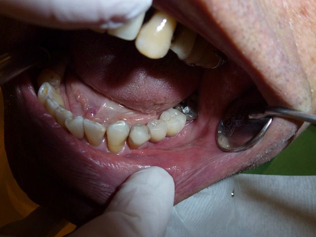 procedimiento dental en un sueño