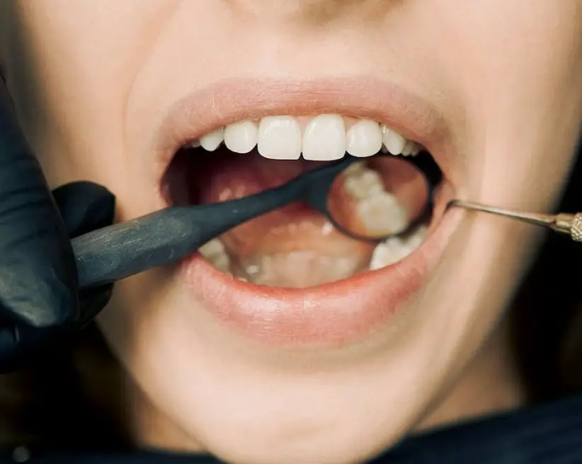 Los dientes son esenciales para la comunicación verbal y la expresión